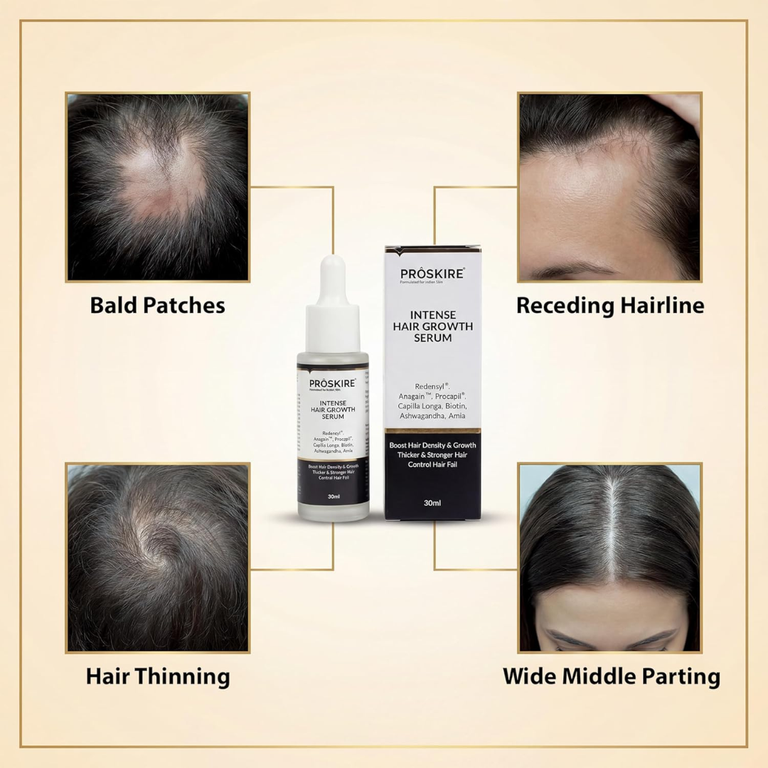 Proskire Hair Growth Serum – Reduces Hair Fall, Boosts Density, Activates Follicles – For Bald Patches, Receding Hairline & Thinning Hair